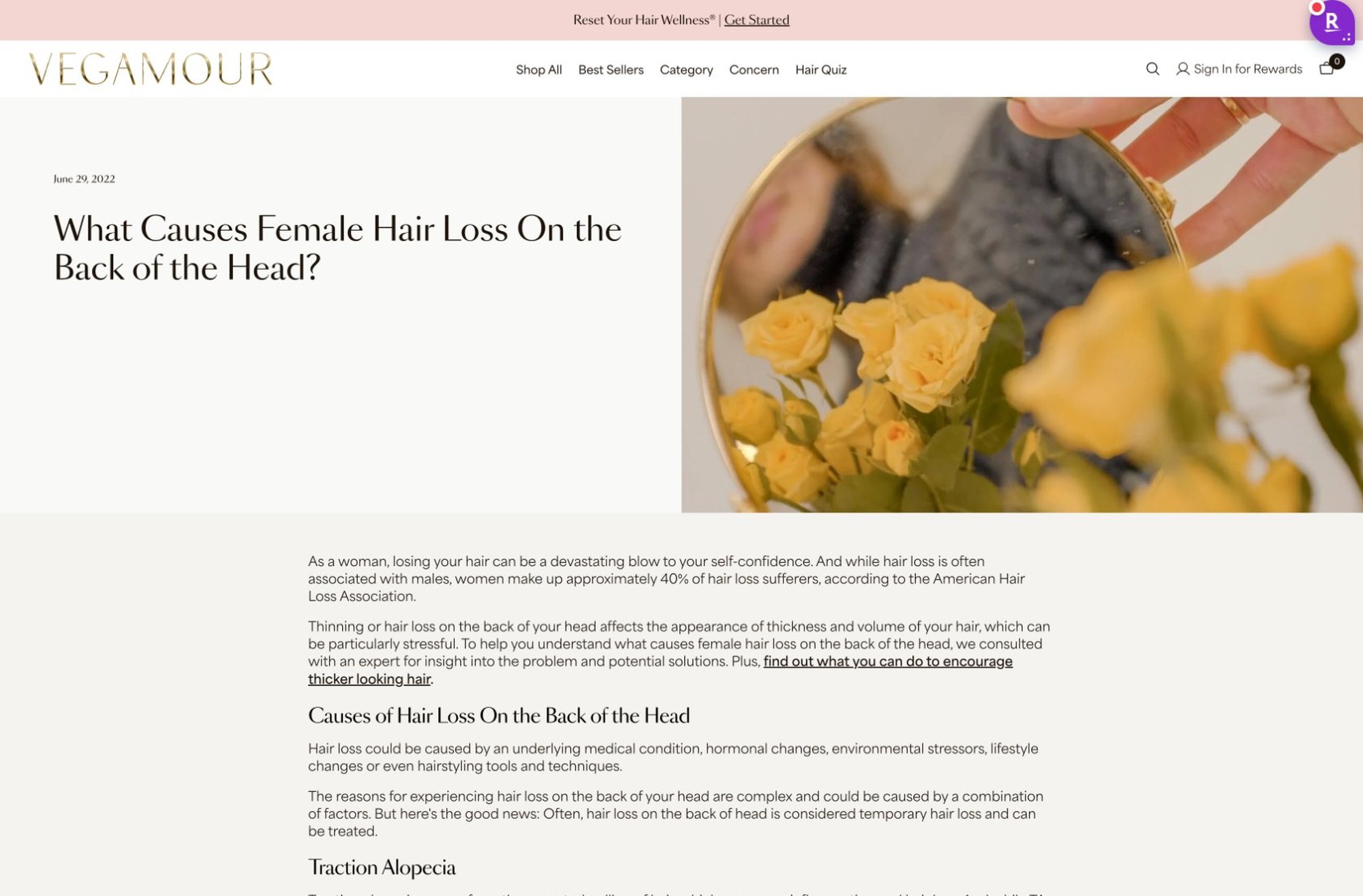 VEGAMOUR article, What Causes Female Hair Loss On the Back of the Head